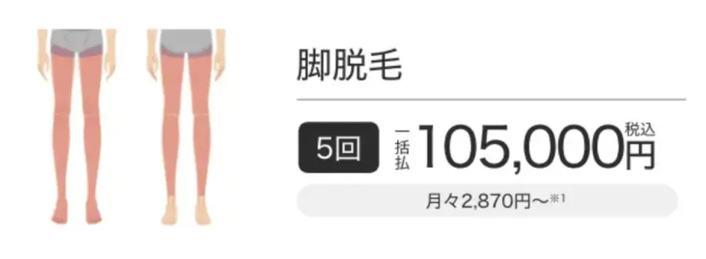 メンズ脱毛_エミナルクリニックメンズ_脚脱毛