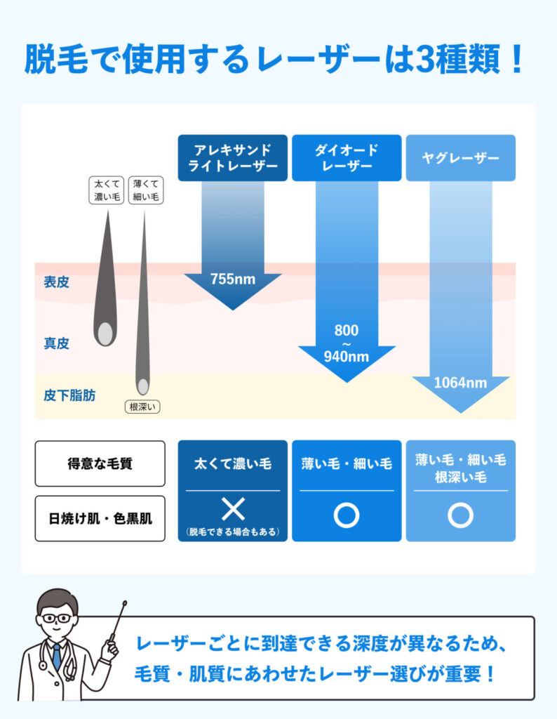メンズ脱毛_レーザーの種類