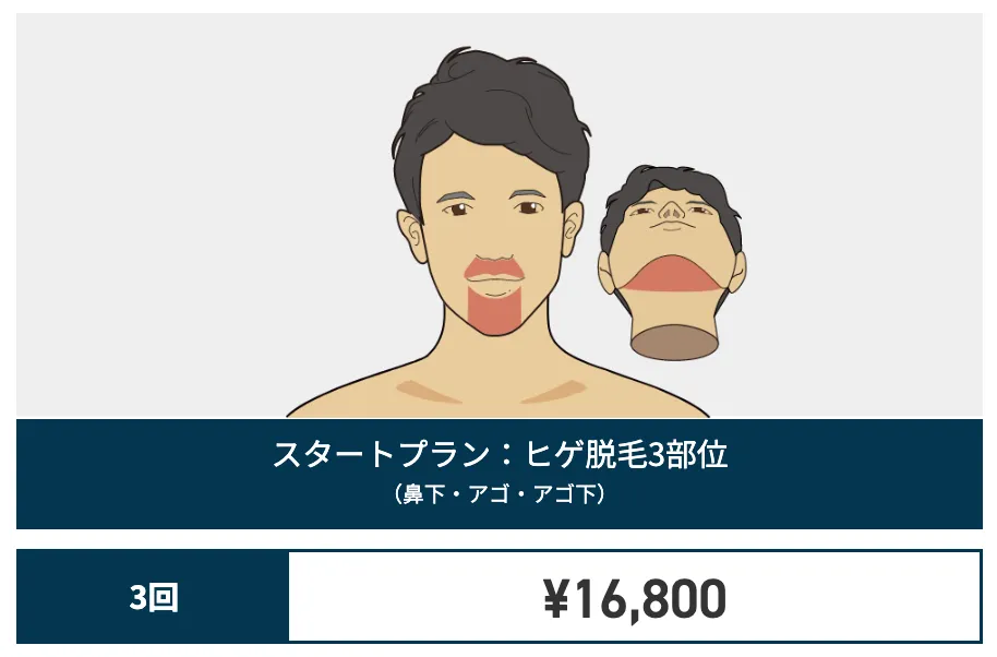 ゴリラ_ヒゲ料金_お試し