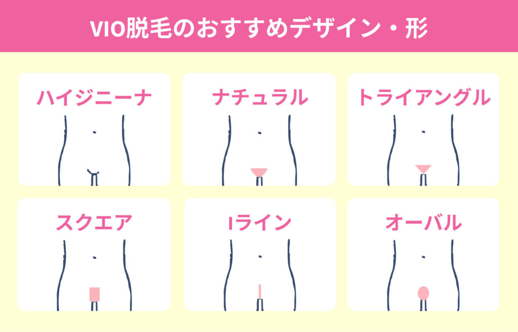 VIO脱毛のおすすめデザイン・形